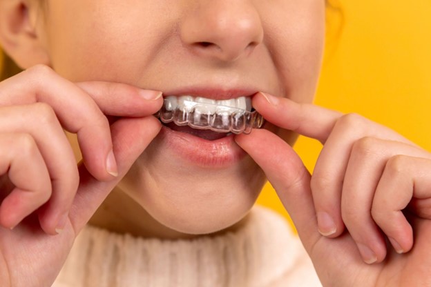 A young girl places Invisalign trays on her upper teeth after beginning treatment in Oak Park, IL 