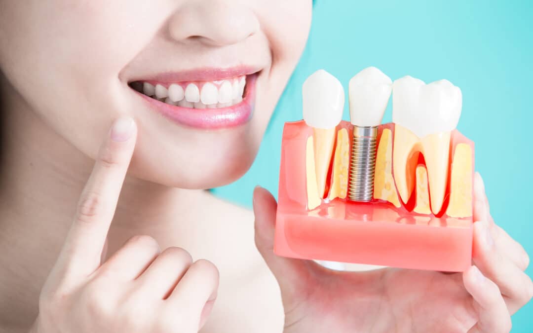 asian woman holding up a model of healthy dental implants