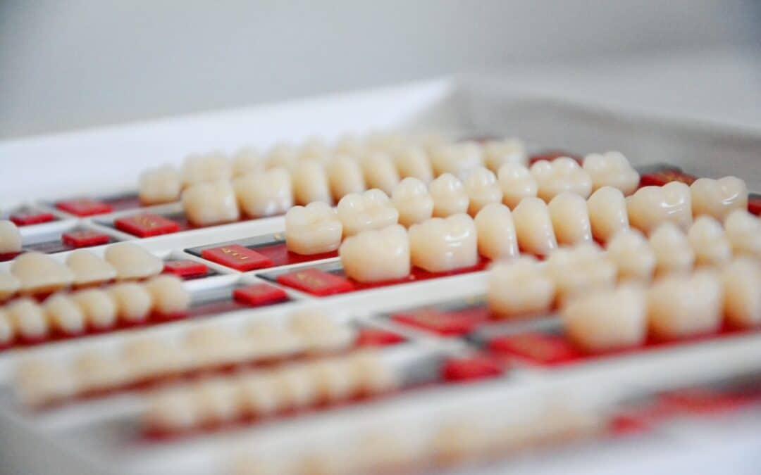 dental crowns and veneers on dental tray
